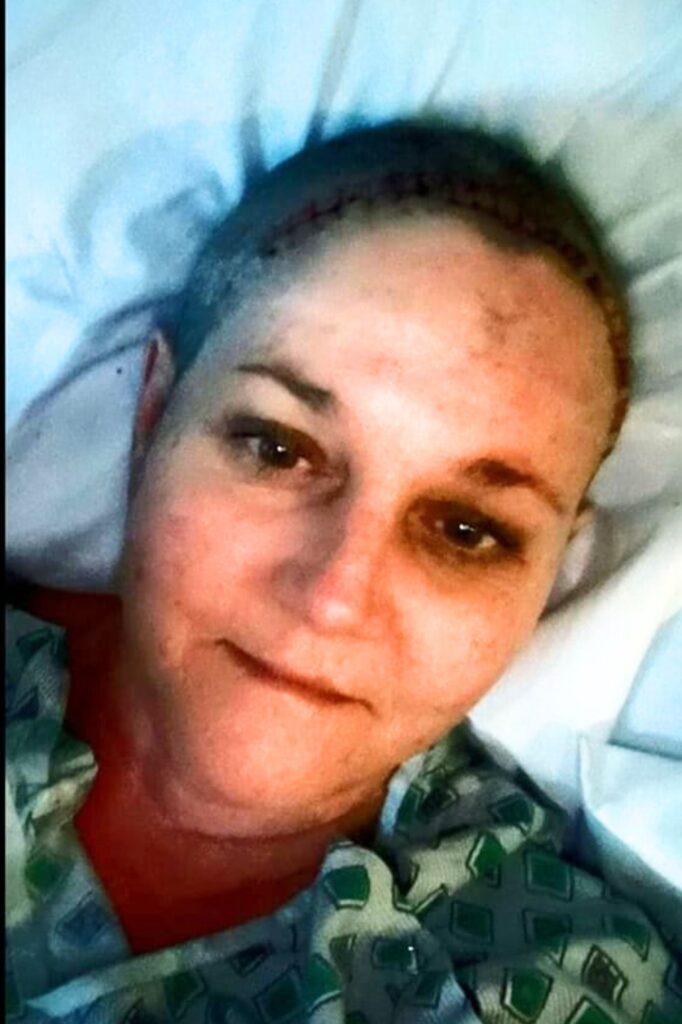 Kelly Swingle pictured after her third brain cancer surgery in 2019